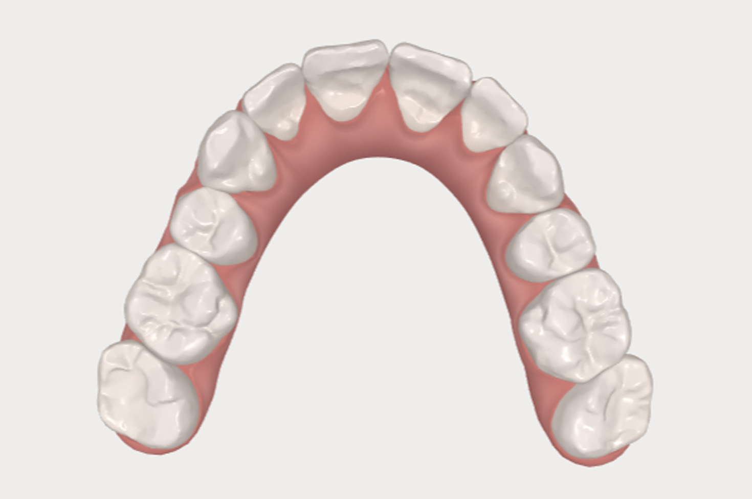 Simulation images of before and after teeth straightening