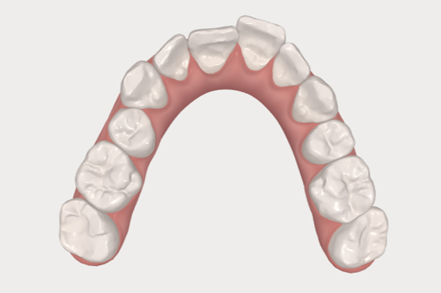 Simulation images of before and after teeth straightening