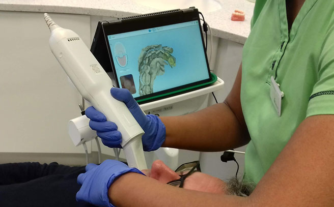 image-invisalign-scanner-leeds-dental-practice